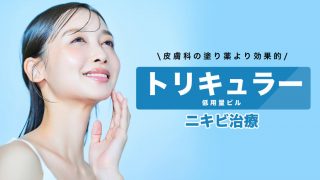 ニキビ治療にトリキュラー(低用量ピル)を使う。皮膚科の塗り薬より効果が出やすい